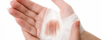 ПЕРВАЯ ПОМОЩЬ. ЧАСТЬ 4. КРОВОТЕЧЕНИЕ