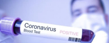 КОРОНАВИРУС: эвакуированные украинцы здоровы, у украинки в Италии выявили коронавирус Covid-19