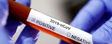 В Украине официально заявили о первом человеке, который выздоровел от коронавируса