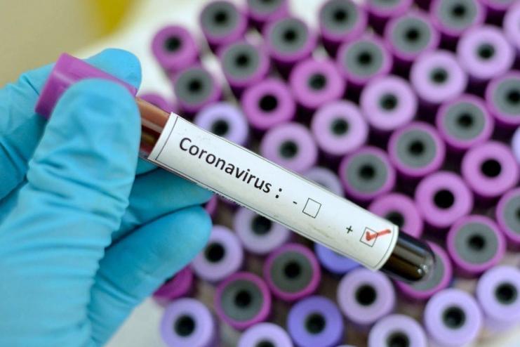В Україні зафіксовано 418 випадків COVID-19