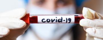 За сутки у 135 украинцев диагностирован COVID-19