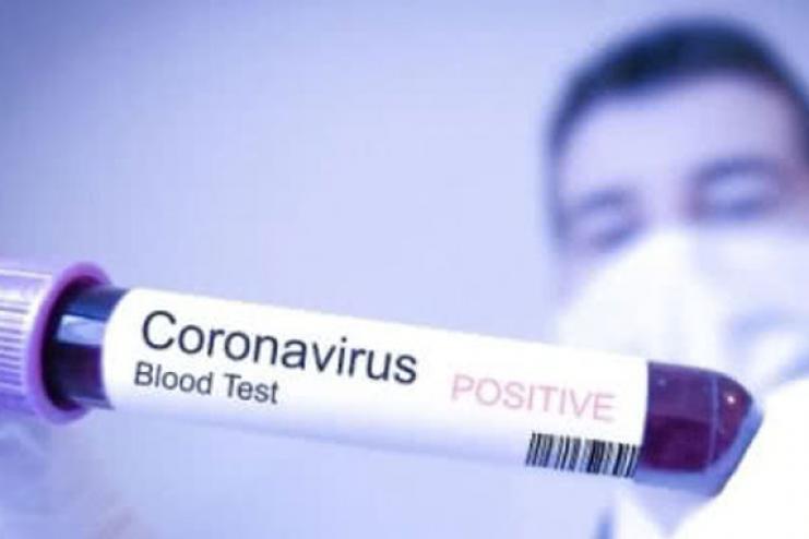 На Одещині підтверджено ще чотири випадки COVID-19.