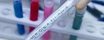 По результатам ПЦР-тестирования, все контактные лица с первыми двумя заболевшими COVID-19 в Килийском районе, здоровы 