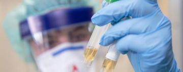 В Україні зафіксовано 5449 випадків COVID-19