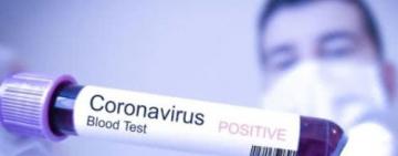  COVID-19: в Україні 477 нових випадків зараження