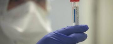 В Україні зафіксовано 10 861 випадок COVID-19