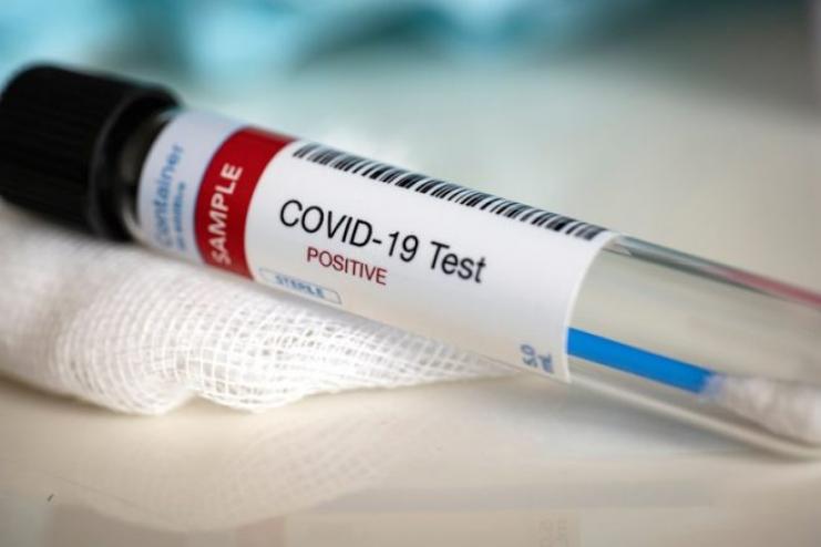 Ранковий брифінг очільника МОЗ та дані щодо COVID-19: головні тези