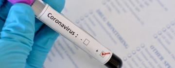 COVID-19: на Одещині за добу виявлено 36 випадків, в Україні +515 випадків