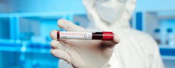 В Україні за добу ще у 325 людей виявили Covid-19