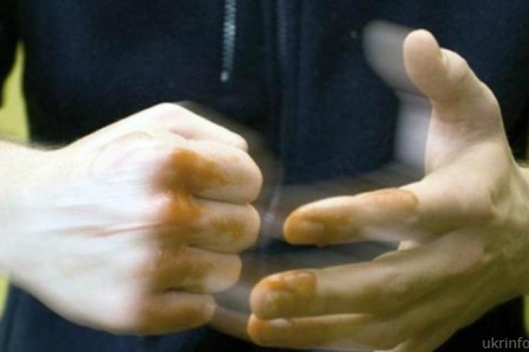 В Болграде местный житель заявил, что его избили полицейские