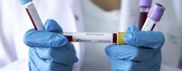  Одесская лаборатория, из-за вспышки COVID-19 среди сотрудников, приостановила ПЦР-тестирование 