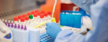  ИФА-тест при плановой госпитализации пациента должны делать бесплатно, - Степанов