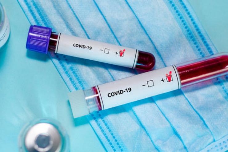 COVID-19: дані ОДА по районам Одещини станом на 10 грудня