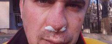 В Одессе сотрудники охранной фирмы жестоко избили ветерана АТО (фото)