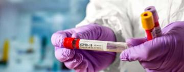 Одещина у лідерах за кількістю нових випадків коронавірусної хвороби за минулу добу  