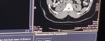 Килограмм кокаина в желудке: правоохранители ликвидировали канал международного наркотрафика  