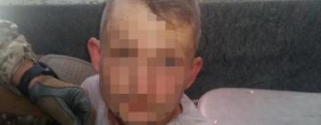 ВЗРЫВЫ В ПОЧТОМАТАХ ОДЕССЫ И КИЕВА: ЗАДЕРЖАН ПОДОЗРЕВАЕМЫЙ