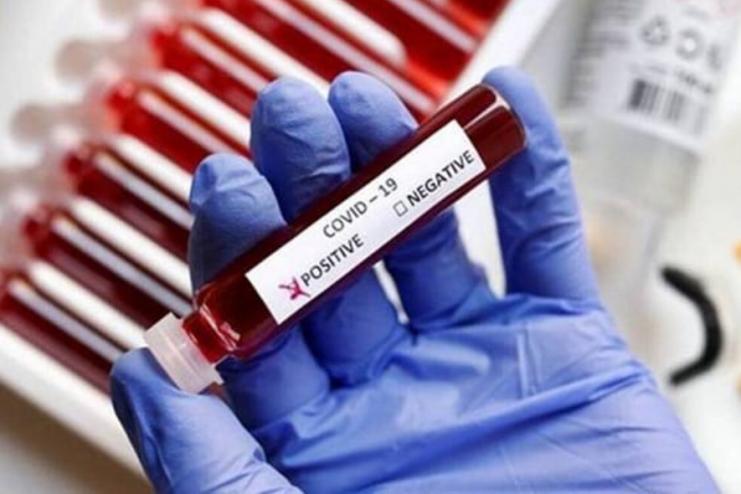 Одещина рекордсмен по захворюваності на коронавірус: 43 летальних випадки за добу