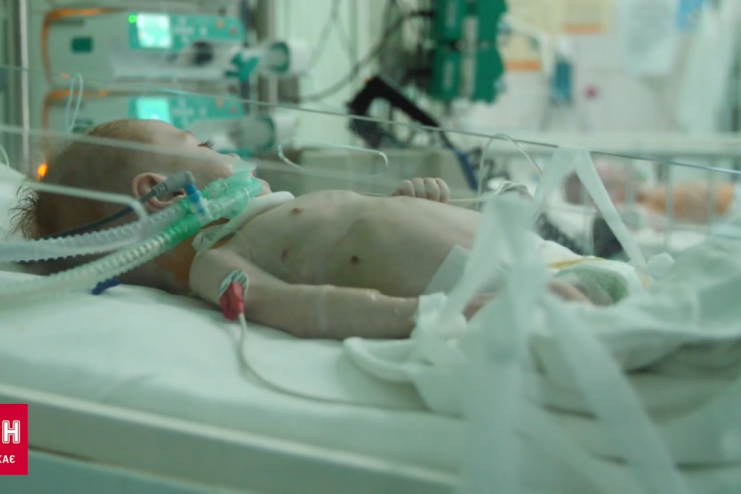 У родині хлопчика із поліомієлітом ще у шістьох дітей виявили вірус: малюк вже не стає на ноги