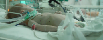 У родині хлопчика із поліомієлітом ще у шістьох дітей виявили вірус: малюк вже не стає на ноги