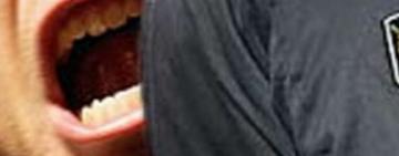 В Одесской области полицейский отсудил 50 тыс грн у парня, который его покусал