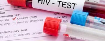 Сьогодні в Ізмаїлі можна безкоштовно пройти тест на ВІЛ 