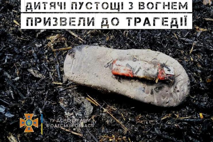 Трагедія на Одещині: маленький хлопчик грався з вогнем і отримав 90 відсотків опіків тіла