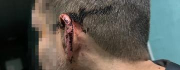 У військовій частині на Одещині побили військового – ДБР