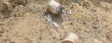 На Одещині двох підлітків  доставили з дому у лікарню з термічно-хімічними опіками