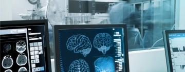 В Одесі вперше штучний інтелект долучили до діагностики головного мозку