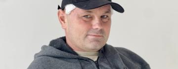 Лікарі відновили 3D-пластинами череп військового, в голову якому влучила ворожа куля