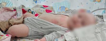 Жінку та двомісячну дівчинку, які вчора потрапили під обстріл у передмісті Херсона, евакуюють до Одеси.