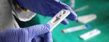 671 випадок ВІЛ виявлено в Одесі за 2023 рік