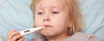 Повернулася з-за кордону: на Ізмаїльщині захворіла вакцинована дитина