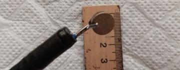 В Аккермані лікарі врятували дівчинку, яка проковтнула батарейку-«таблетку»