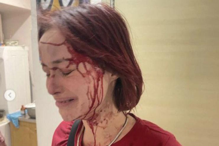 Жертва чи провокатор? Одеситка, яка стверджує, що її побив військовий, з заявою до поліції не зверталась
