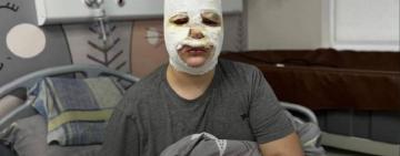 Тренди в TikTok стають небезпечними для українських дітей: три хлопчики постраждали через невдалий експеримент