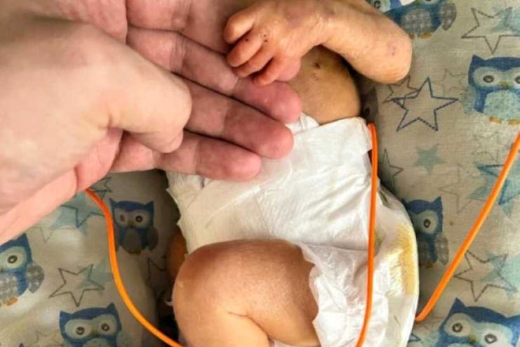 Крихітне серце, велика боротьба: як в Одесі врятували передчасно народжену дитину