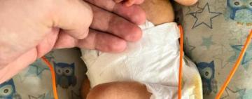 Крихітне серце, велика боротьба: як в Одесі врятували передчасно народжену дитину