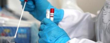 На Одещині зберігається низький рівень захворюваності на грип та ГРВІ