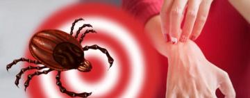 В Одеській області зареєстрували підозру на хворобу Лайма