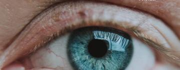 Операція на катаракту – безоплатно: що потрібно знати пацієнтам в Україні