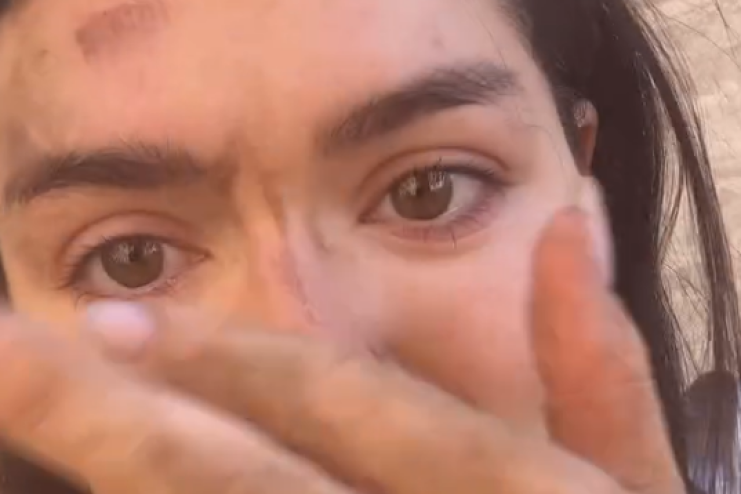 В Одесі серед білого дня невідомий напав на учасницю «Холостяка»