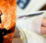 Пожежа в багатоквартирному будинку в Кілії: чоловік у тяжкому стані госпіталізований