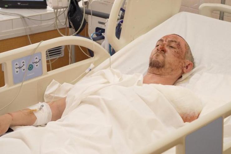 12 годин між життям і смертю: військовий з Одещини втратив руку після атаки дрона, але вижив