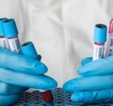 В Україні зафіксували перший випадок субваріанту COVID-19 «Цикада» — МОЗ