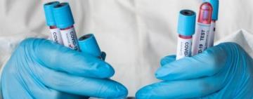 В Україні зафіксували перший випадок субваріанту COVID-19 «Цикада» — МОЗ