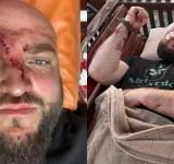 Побиття ветерана АТО через російську музику в Затоці: поліція відкрила справу, нападником виявився житель Подільська